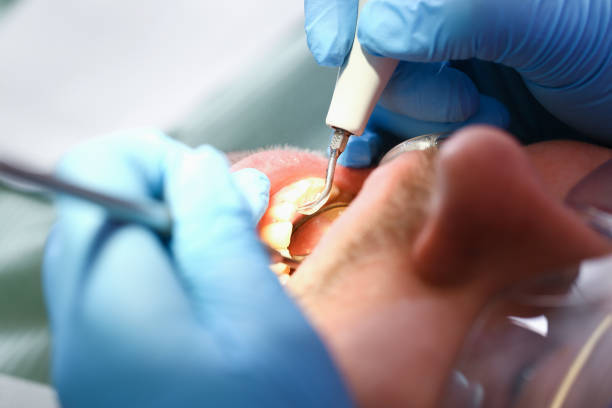 Best Emergency Wisdom Teeth Removal in Presidential Lakes Estates, NJ